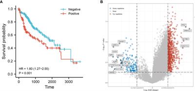 Comprehensive Analysis Identified ASF1B as an Independent Prognostic Factor for HBV-Infected Hepatocellular Carcinoma